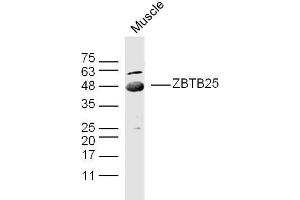 Mouse muscle lysates probed with ZBTB25/ZNF46 Polyclonal Antibody, unconjugated  at 1:300 overnight at 4°C followed by a conjugated secondary antibody at 1:10000 for 90 minutes at 37°C. (ZBTB25 Antikörper  (AA 341-435))