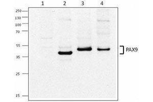 Western Blotting (WB) image for anti-Paired Box 9 (PAX9) antibody (ABIN2665320) (PAX9 Antikörper)