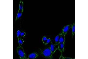 Immunofluorescence analysis of B16 cells using FAK mouse mAb (green). (FAK Antikörper)