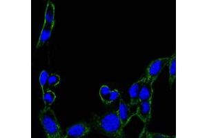 Immunofluorescence analysis of B16 cells using FAK mouse mAb (green). (FAK Antikörper)