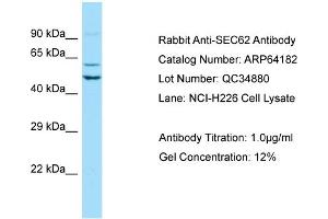 Western Blotting (WB) image for anti-Translocation Protein 1 (TLOC1) (Middle Region) antibody (ABIN2774392)