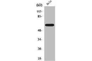 Western Blot analysis of Hela cells using RORα Polyclonal Antibody (RORA Antikörper  (N-Term))