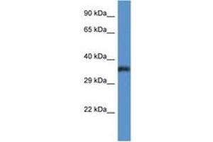 Image no. 1 for anti-Phosphatidylinositol Glycan C (PIGC) (C-Term) antibody (ABIN6746921) (PIGC Antikörper  (C-Term))
