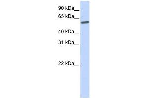 SENP3 antibody used at 1 ug/ml to detect target protein. (SENP3 Antikörper  (N-Term))