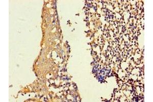 Immunohistochemistry of paraffin-embedded human tonsil tissue using ABIN7155297 at dilution of 1:100 (ASF1B Antikörper  (AA 1-202))