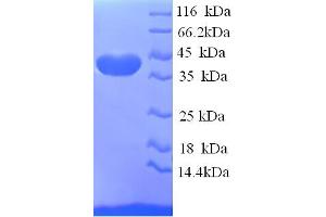 SDS-PAGE (SDS) image for ELAV (Embryonic Lethal, Abnormal Vision, Drosophila)-Like 2 (Hu Antigen B) (ELAVL2) (AA 4-356), (partial) protein (His tag) (ABIN5713428)