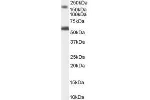 ABIN184627 staining (1µg/ml) of Human Brain (Cerebellum) lysate (RIPA buffer, 35µg total protein per lane). (BAIAP2 Antikörper  (C-Term))