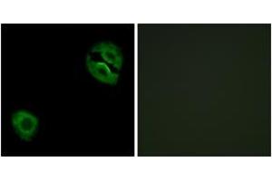 Immunofluorescence analysis of A549 cells, using Collagen XIX alpha1 Antibody. (COL19A1 Antikörper  (AA 421-470))