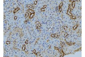 ABIN6272874 at 1/100 staining Mouse kidney tissue by IHC-P. (BBS5 Antikörper  (C-Term))