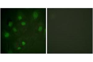 Immunofluorescence analysis of HeLa cells, using IGF2R (Ab-2484) Antibody. (IGF2R Antikörper  (AA 2441-2490))