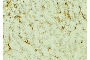 ABIN6277296 at 1/100 staining Mouse kidney tissue by IHC-P. (Dynamin 1-Like Antikörper  (C-Term))