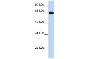 WB Suggested Anti-C16orf44 Antibody Titration:  0. (KLHL36 Antikörper  (Middle Region))
