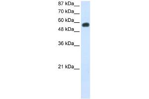 WB Suggested Anti-NOC4L Antibody Titration:  0. (NOC4L Antikörper  (C-Term))