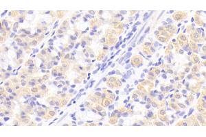 Immunohistochemistry (IHC) image for anti-Interleukin 1 Receptor Antagonist (IL1RN) (AA 26-177) antibody (ABIN7431371)