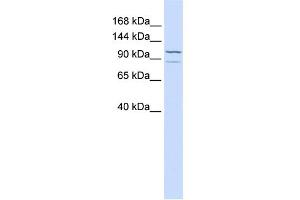 WB Suggested Anti-ADCY6 Antibody Titration:  0. (ADCY6 Antikörper  (C-Term))