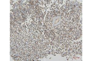 IHC analysis of VDAC3 using anti-VDAC3 antibody (ABIN7602541).