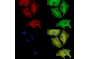 ABIN7097135 and ABIN7101203 staining  cells by IF/ICC. (CRELD2 Antikörper)