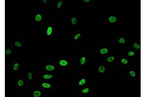 Immunofluorescent analysis of Hela cells treated with NaB using ABIN7139173 at dilution of 1:100 and Alexa Fluor 488-congugated AffiniPure Goat Anti-Rabbit IgG(H+L) (HIST1H3A Antikörper  (acLys23))