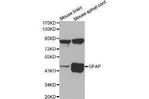 Western Blotting (WB) image for anti-Glial Fibrillary Acidic Protein (GFAP) (C-Term) antibody (ABIN6213705) (GFAP Antikörper  (C-Term))