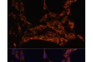 Immunofluorescence analysis of C6 cells using IL18 Polyclonal Antibody at dilution of 1:100. (IL-18 Antikörper)