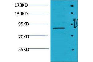 Western Blotting (WB) image for anti-Signal Transducer and Activator of Transcription 5A (STAT5A) antibody (ABIN3179114) (STAT5A Antikörper)