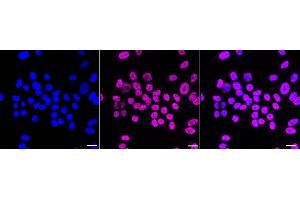 Immunocytochemical staining of HepG2 cells with Forkhead box A1 antibody (ABIN7798641), 1:1,000). (Rekombinanter FOXA1 Antikörper)