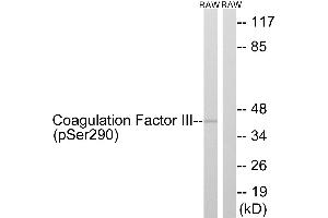 Immunohistochemistry analysis of paraffin-embedded human brain tissue using Coagulation Factor III (Phospho-Ser290) antibody. (Tissue factor Antikörper  (pSer290))