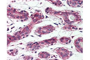 Anti-TAOK1 antibody IHC of human breast. (TAO Kinase 1 (TAOK1) (Internal Region) Antikörper)