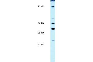WB Suggested Anti-PAntibody Titration:  0. (PARP11 Antikörper  (N-Term))