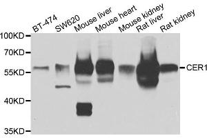 Western blot analysis of extracts of various cell lines, using CER1 antibody. (CER1 Antikörper)