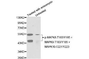 Western blot analysis of extracts from C6 cells untreated or treated with anisomycin using Phospho-MAPK8-T183/Y185 + MAPK9-T183/Y185 + MAPK10-T221/Y223 Antibody (ABIN2987800). (MAPK8/9/10 Antikörper  (pThr183, pThr221, pTyr185))