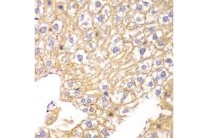Immunohistochemistry of paraffin-embedded mouse liver using PP2A-B55α/PR55α/PPP2R2A antibody (ABIN3023153, ABIN3023154, ABIN3023155 and ABIN6219415) at dilution of 1:100 (40x lens).