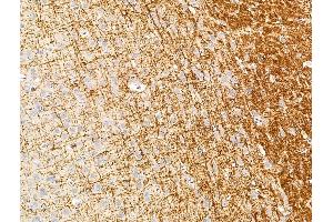 anti-NLR Family, CARD Domain Containing 5 (NLRC5) (Internal Region) antibody