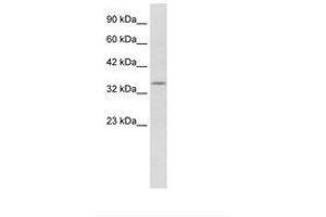 Image no. 1 for anti-Potassium Voltage-Gated Channel, Shaker-Related Subfamily, beta Member 2 (KCNAB2) (AA 240-289) antibody (ABIN202321)