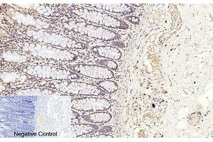 Immunohistochemical analysis of paraffin-embedded human colon tissue. (Caspase 3 p17 (AA 100-180), (Cleaved-Asp175) Antikörper)