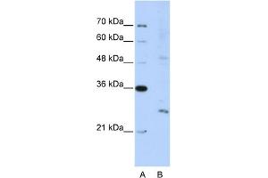 WB Suggested Anti-EXOSC4 Antibody Titration:  5.