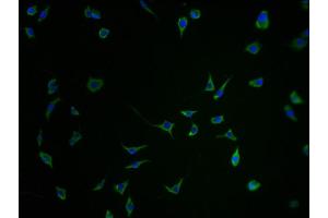 Immunofluorescence staining of SH-SY5Y cells with ABIN7168758-IF at 1:100, counter-stained with DAPI. (SEZ6 Antikörper  (AA 20-267))