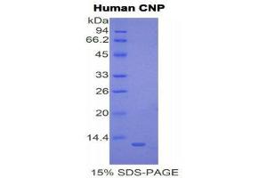 SDS-PAGE (SDS) image for Natriuretic Peptide Type C (NPPC) (AA 33-125) protein (His tag) (ABIN1877378) (NPPC Protein (AA 33-125) (His tag))