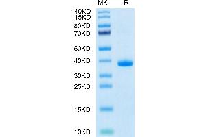 SDS-PAGE (SDS) image for Epidermal Growth Factor (EGF) (AA 977-1029) protein (Fc Tag) (ABIN7274530)