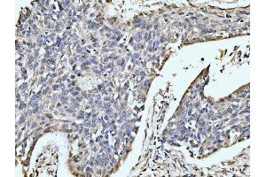 IHC analysis of MOV10 using anti-MOV10 antibody (ABIN7600236). (MOV10 Antikörper  (AA 167-772))