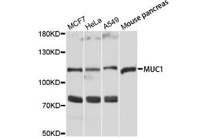 Western blot analysis of extracts of various cell lines, using MUC1 antibody. (MUC1 Antikörper)
