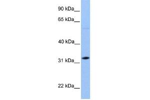 WB Suggested Anti-DNALI1 Antibody Titration: 0. (DNALI1 Antikörper  (C-Term))