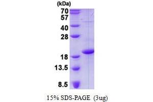 Image no. 1 for CD83 (CD83) protein (His tag) (ABIN1098522) (CD83 Protein (CD83) (His tag))
