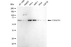 Western blotting analysis using CBFA2T3 antibody (ABIN7798156).