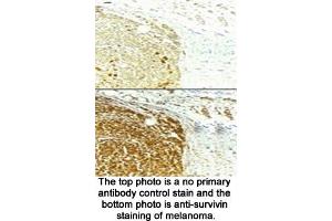 Image no. 2 for anti-Baculoviral IAP Repeat-Containing 5 (BIRC5) (full length) antibody (ABIN363387) (Survivin Antikörper  (full length))