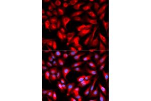 Immunofluorescence analysis of U2OS cells using CD168/RHAMM antibody (ABIN6131278, ABIN6141879, ABIN6141880 and ABIN6216074). (HMMR Antikörper  (AA 1-300))