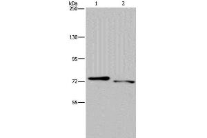 Western Blot analysis of Mouse heart and skeletal muscle tissue using NLRP10 Polyclonal Antibody at dilution of 1:300 (NLRP10 Antikörper)
