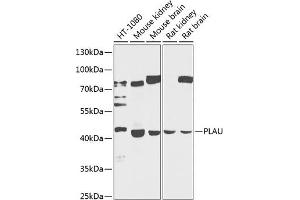 Western blot analysis of extracts of various cell lines, using PLAU antibody (ABIN3023141, ABIN3023142, ABIN3023143 and ABIN6219409) at 1:1000 dilution. (PLAU Antikörper  (AA 20-180))