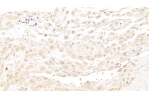 Detection of MBP in Human Placenta Tissue using Monoclonal Antibody to Major Basic Protein (MBP) (Major Basic Protein Antikörper  (AA 105-222))