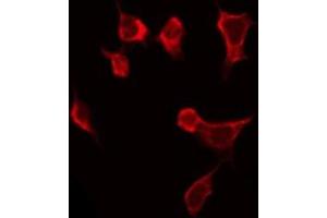 ABIN6268924 staining HeLa by IF/ICC. (TNFSF13 Antikörper  (Internal Region))